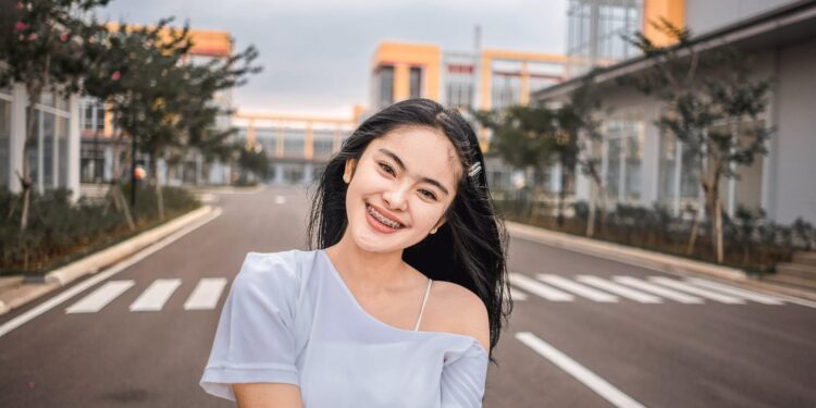 Warna Karet Behel Yang Bagus untuk Wanita